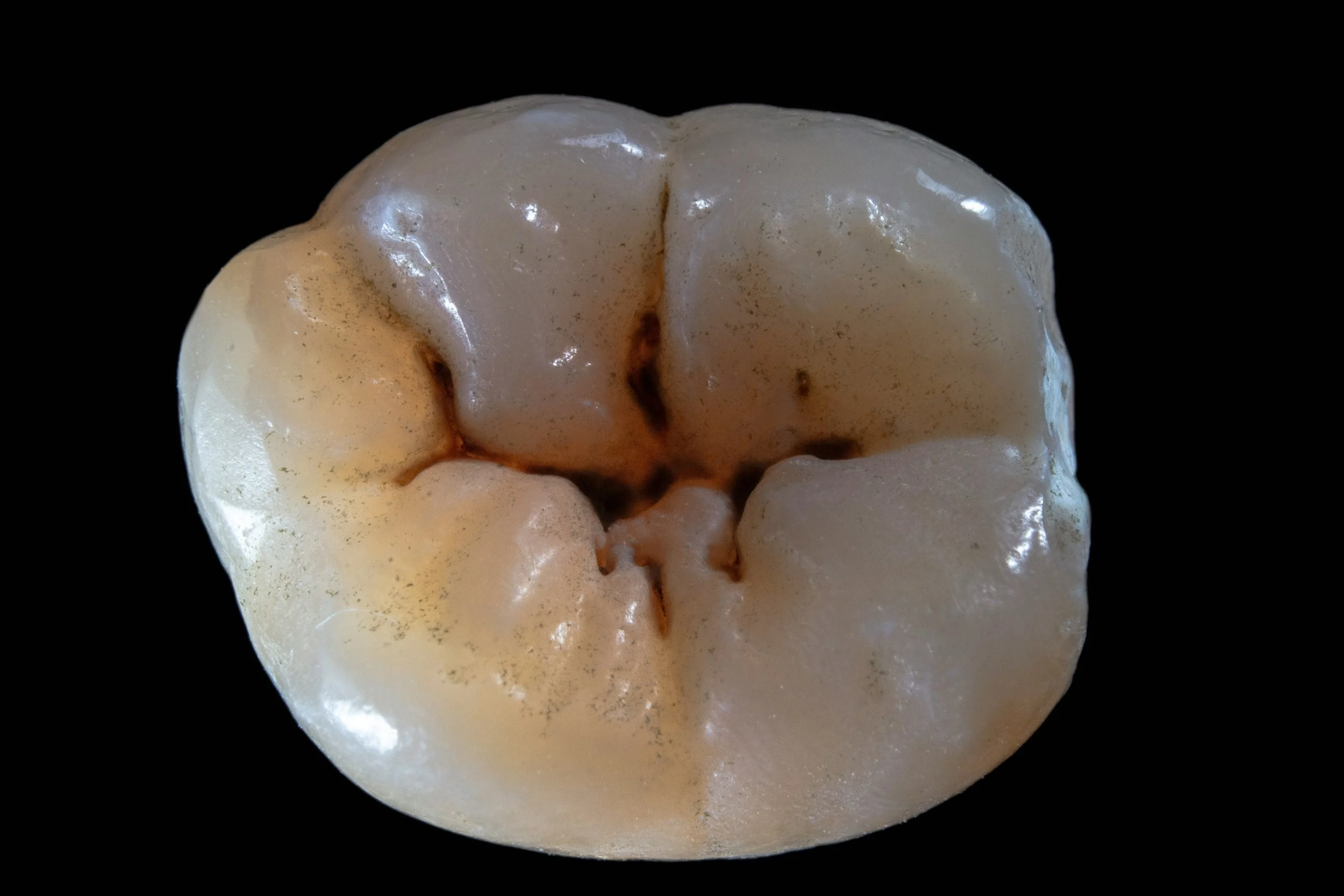 Close-up of a human molar, showing visible signs of dental decay and staining in the grooves and pits of the tooth surface.