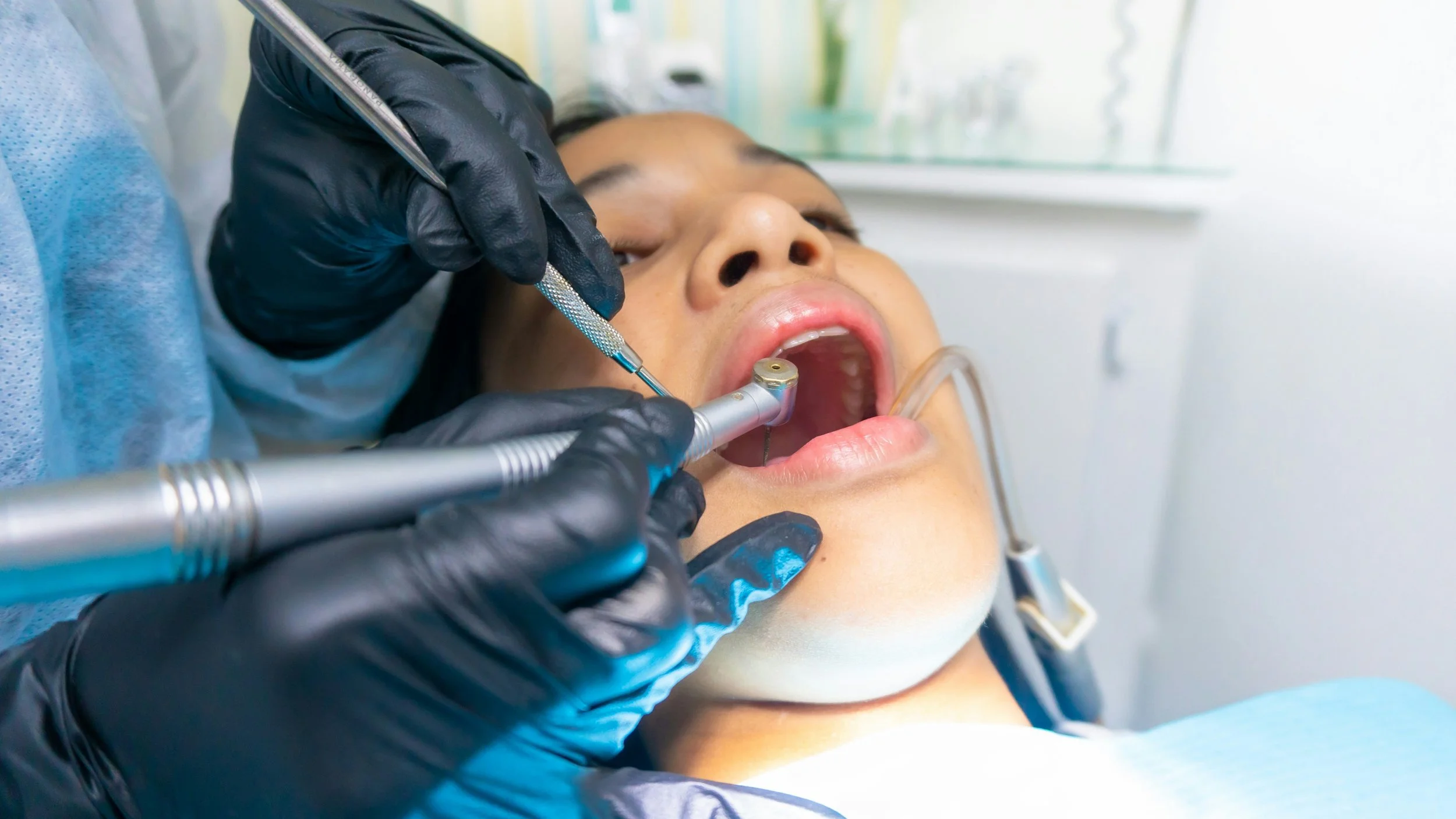 Patient receiving dental treatment with a high-speed handpiece while a dentist wearing black gloves performs a procedure inside the open mouth.