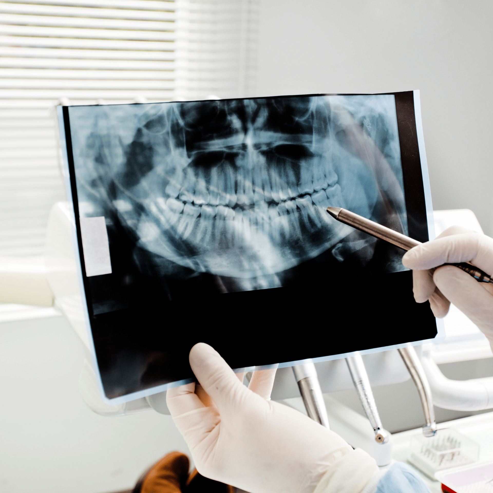 Digital X-Rays